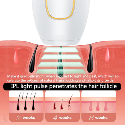 IPL Laser Epilator Body